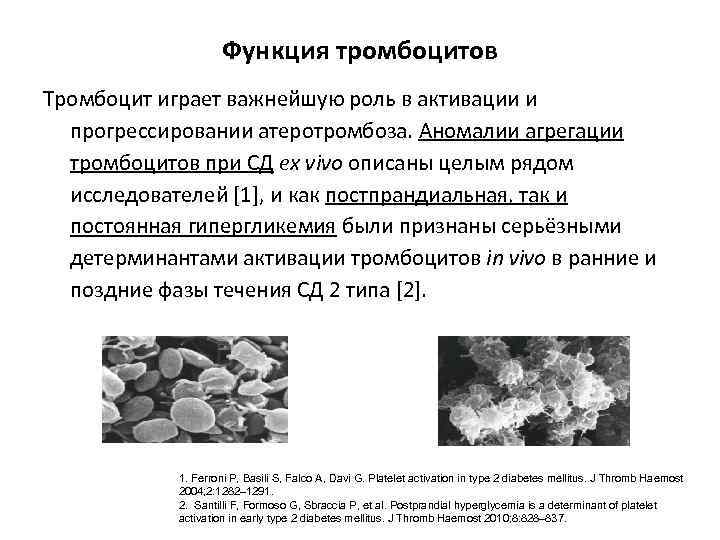Функция тромбоцитов Тромбоцит играет важнейшую роль в активации и прогрессировании атеротромбоза. Аномалии агрегации тромбоцитов