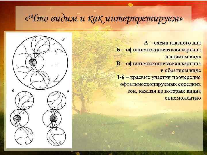 Схема глазного дна