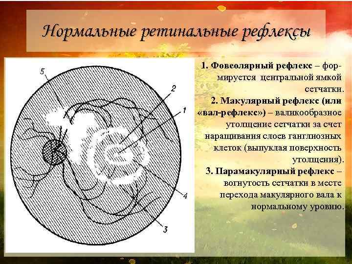 Нормальные ретинальные рефлексы 1. Фовеолярный рефлекс – фор мируется центральной ямкой сетчатки. 2. Макулярный