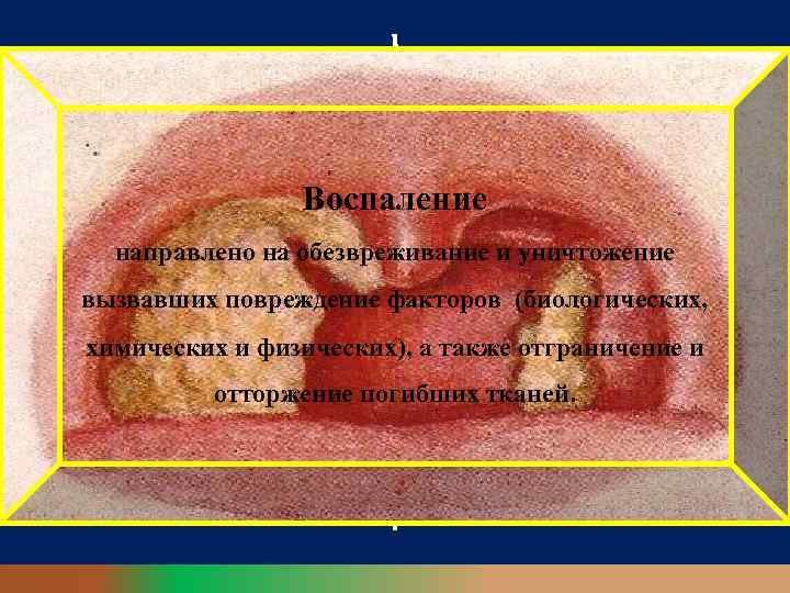 Воспаление направлено на обезвреживание и уничтожение вызвавших повреждение факторов (биологических, химических и физических), а