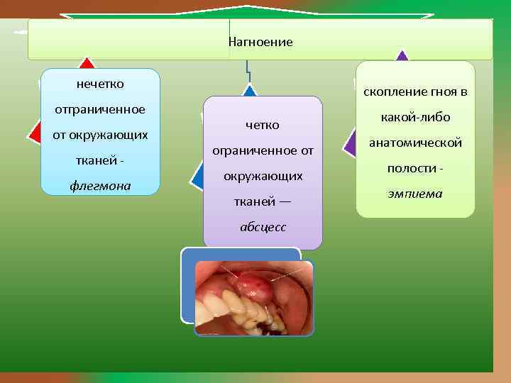 Ограниченное скопление гноя в тканях