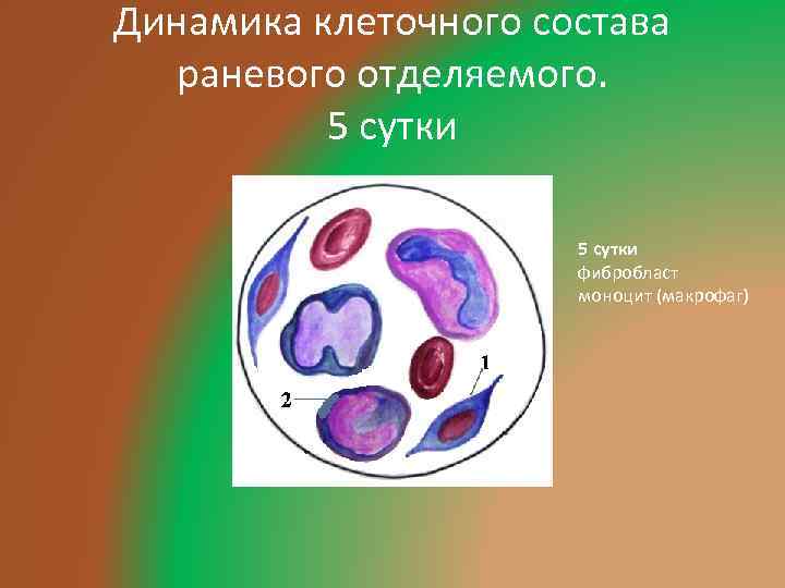 Динамика клеточного состава раневого отделяемого. 5 сутки фибробласт моноцит (макрофаг) 