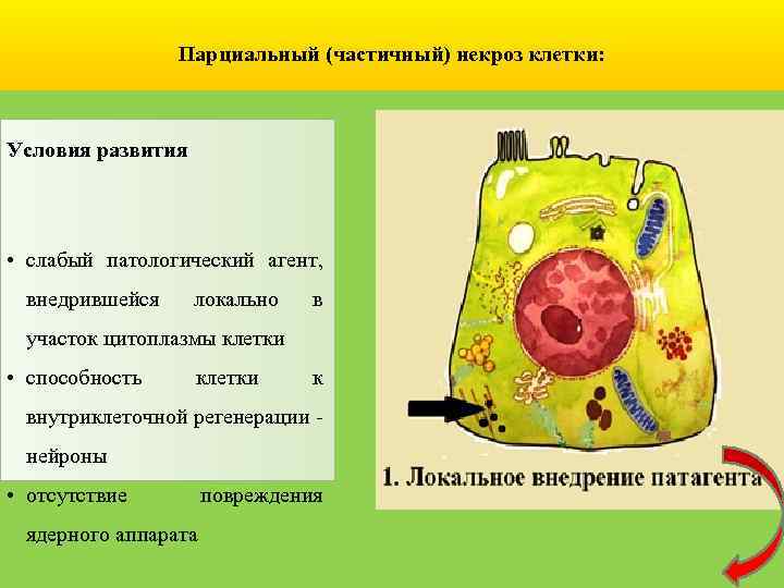 Парциальный (частичный) некроз клетки: Условия развития • слабый патологический агент, внедрившейся локально в участок