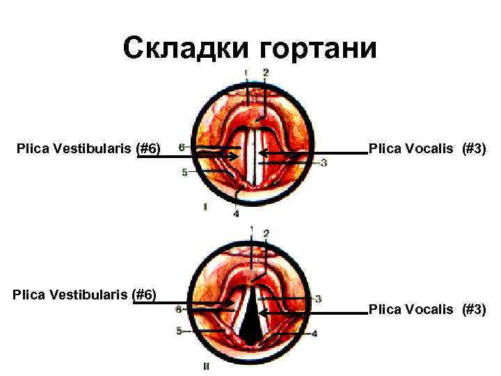 Складки гортани Plica Vestibularis (#6) Plica Vocalis (#3) 