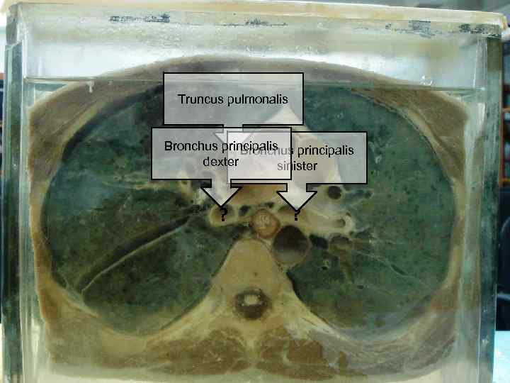 Truncus pulmonalis Bronchus principalis ? dexter sinister ? ? 