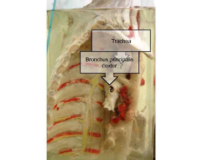 Trachea Bronchus principalis dexter ? ? 