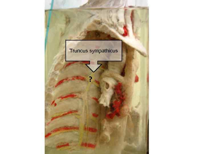 Truncus sympathicus ? 