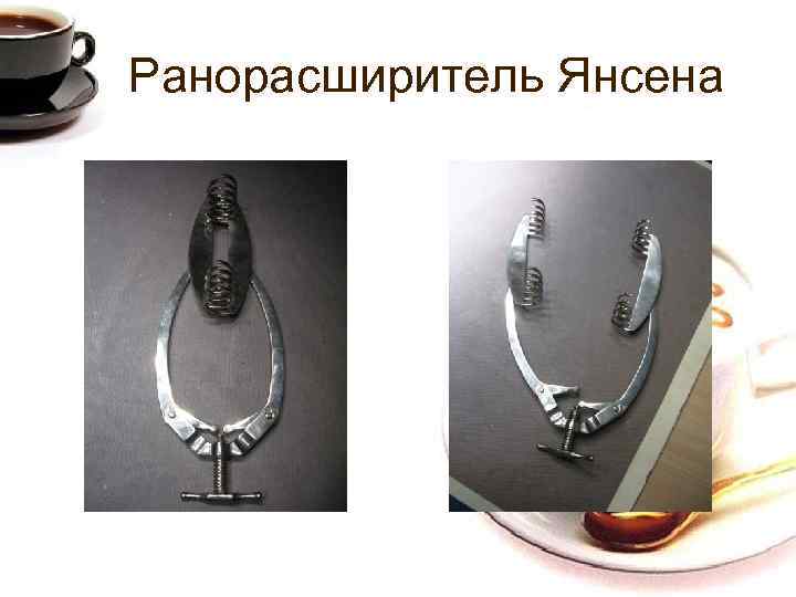 Ранорасширитель Янсена 