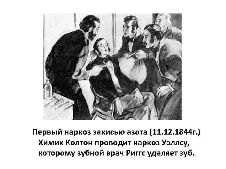 Первый наркоз закисью азота (11. 12. 1844 г. ) Химик Колтон проводит наркоз Уэллсу,