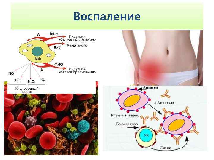 Воспаление 