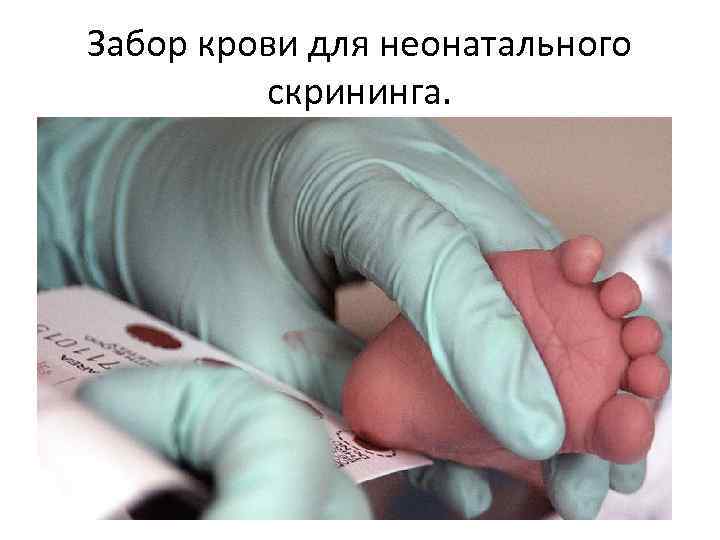 Забор крови для неонатального скрининга. 