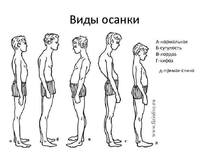 Рассмотрите рисунки 1 4 на каком из них изображен подросток с нормальной осанкой