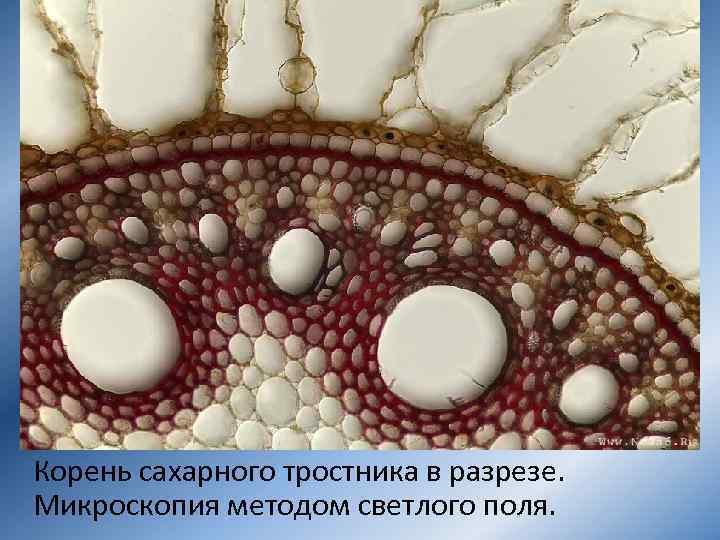 Корень сахарного тростника в разрезе. Микроскопия методом светлого поля. 