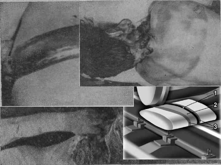 Полоса давления Полоса обтирания 