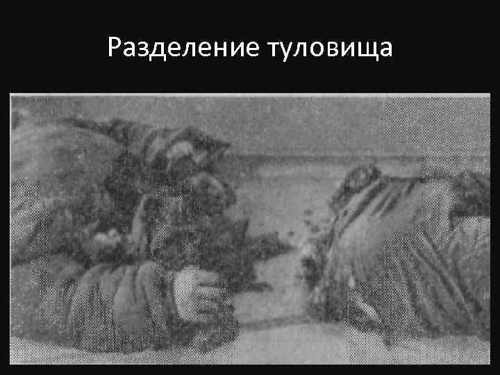 Разделение туловища 