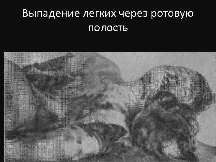 Выпадение легких через ротовую полость 