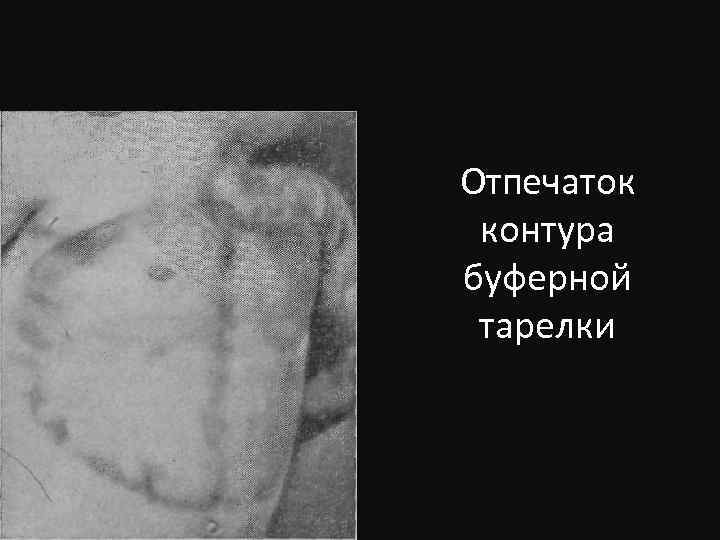 Отпечаток контура буферной тарелки 