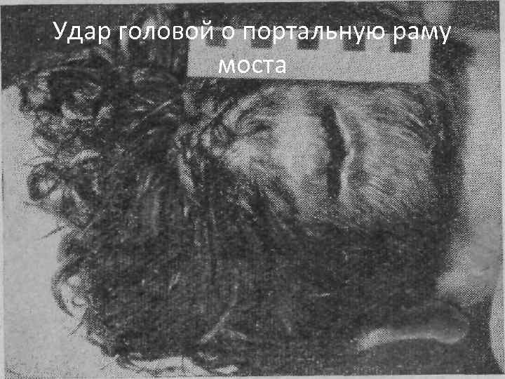 Удар головой о портальную раму моста 