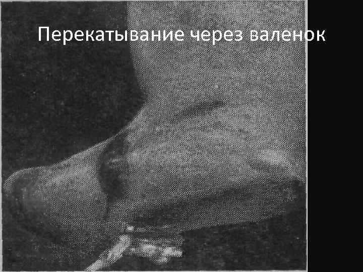 Перекатывание через валенок 