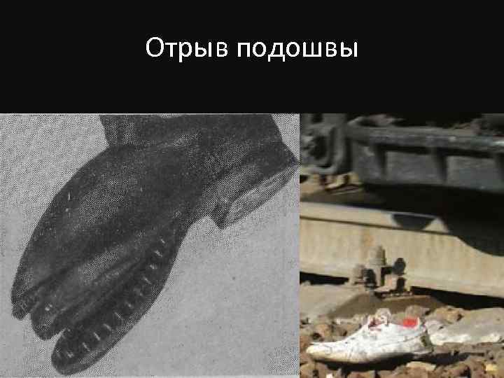 Отрыв подошвы 