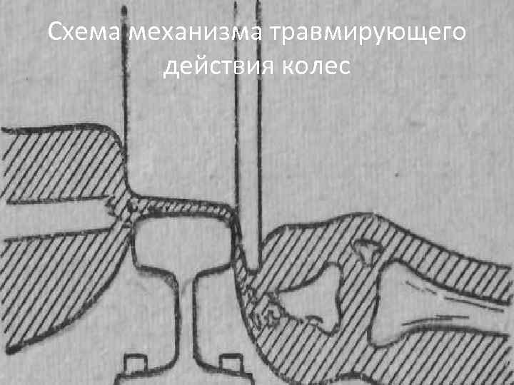 Схема механизма травмирующего действия колес 