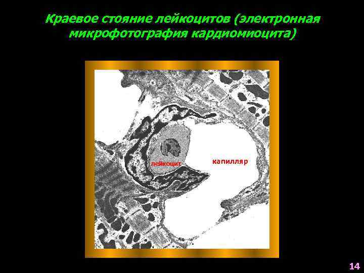 Краевое стояние лейкоцитов (электронная микрофотография кардиомиоцита) лейкоцит капилляр 14 