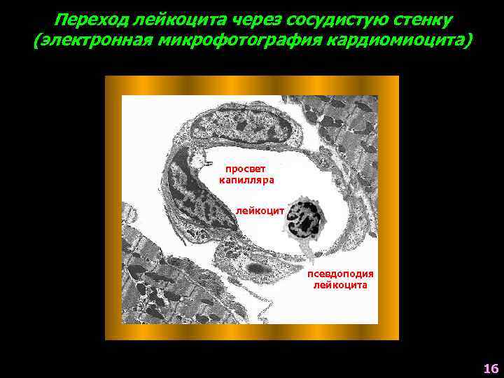 Переход лейкоцита через сосудистую стенку (электронная микрофотография кардиомиоцита) просвет капилляра лейкоцит псевдоподия лейкоцита 16