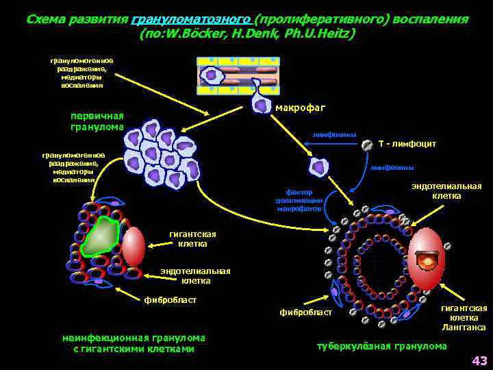 Схема развития грануломатозного (пролиферативного) воспаления (по: W. Böcker, H. Denk, Ph. U. Heitz) грануломогенное