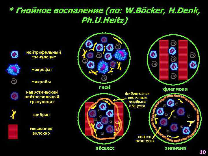 * Гнойное воспаление (по: W. Böcker, H. Denk, Ph. U. Heitz) нейтрофильный гранулоцит макрофаг