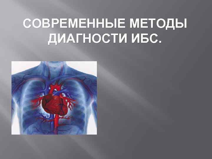 СОВРЕМЕННЫЕ МЕТОДЫ ДИАГНОСТИ ИБС. 