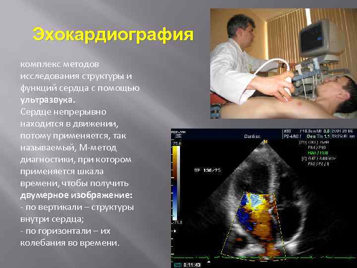 Эхокардиография комплекс методов исследования структуры и функций сердца с помощью ультразвука. Сердце непрерывно находится