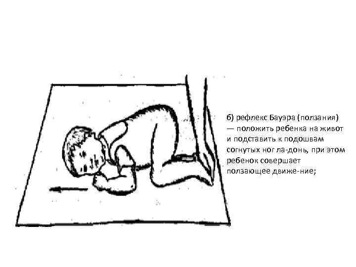 б) рефлекс Бауэра (ползания) — положить ребенка на живот и подставить к подошвам согнутых