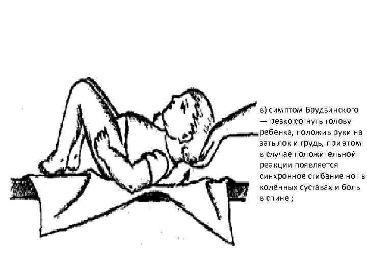 в) симптом Брудзинского — резко согнуть голову ребенка, положив руки на затылок и грудь,