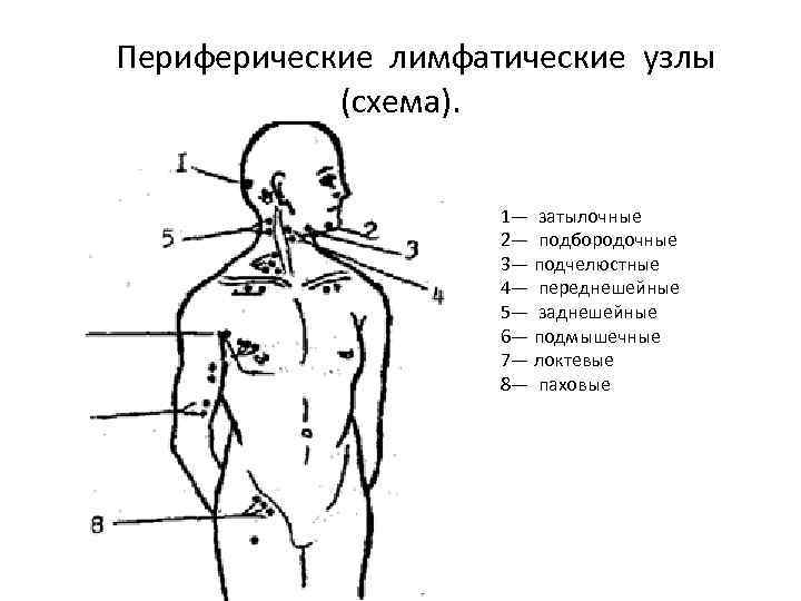 Расположение лимфоузлов на теле человека в картинках