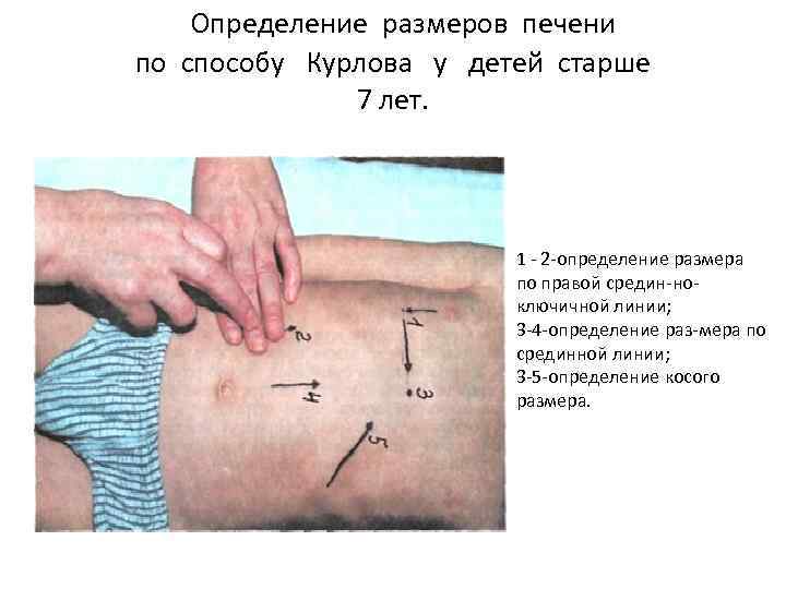 Печень по курлову. Методика определения размеров печени по курлову. Границы печени пальпация у детей. Граница печени при перкуссии по курлову. Пальпация и перкуссия печени по курлову.