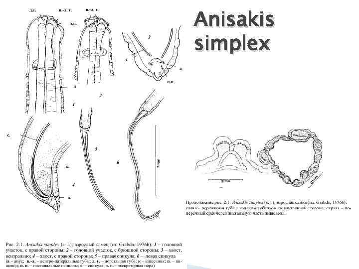 Anisakis simplex 