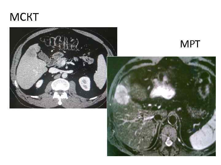 МСКТ МРТ 