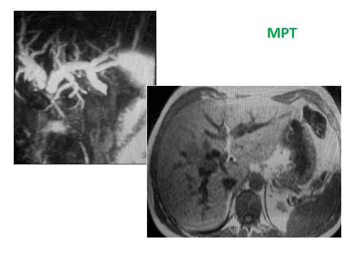 МРТ 
