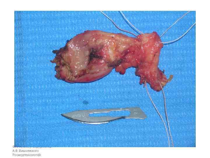 ФГУ Институт хирургии им. А. В. Вишневского Росмедтехнологий 