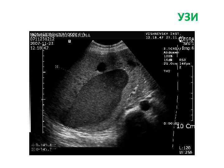 УЗИ 