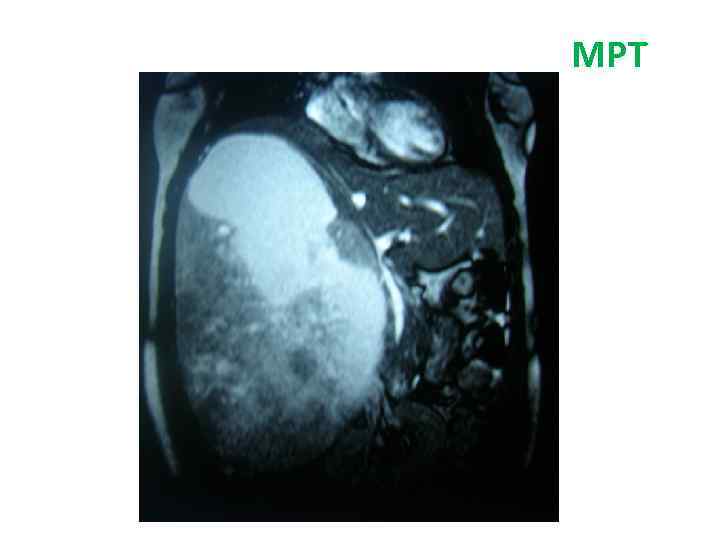МРТ брюшной полости МРТ 