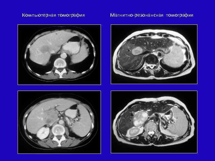 Компьютерная томография Магнитно-резонансная томография 