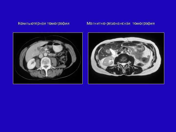 Компьютерная томография Магнитно-резонансная томография 