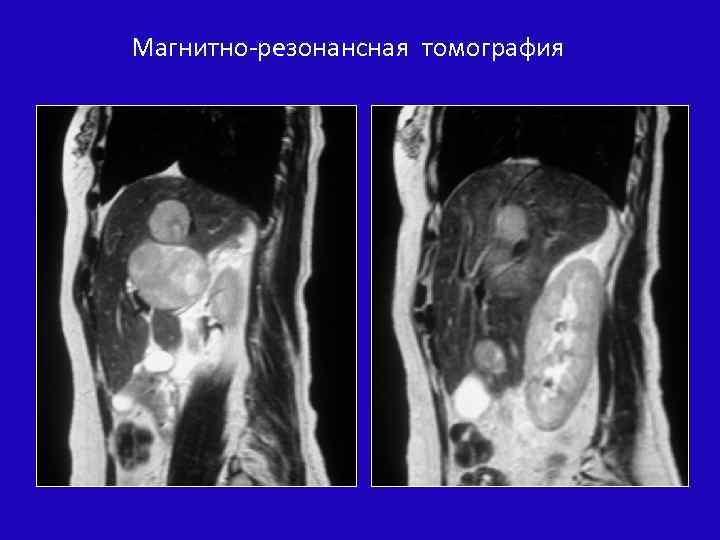 Магнитно-резонансная томография 