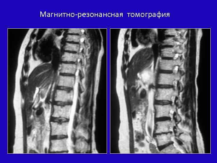 Магнитно-резонансная томография 