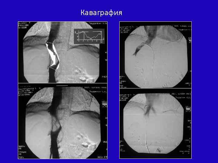 Каваграфия 