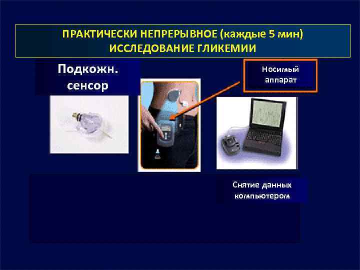 ПРАКТИЧЕСКИ НЕПРЕРЫВНОЕ (каждые 5 мин) ИССЛЕДОВАНИЕ ГЛИКЕМИИ Подкожн. сенсор Носимый аппарат Снятие данных компьютером