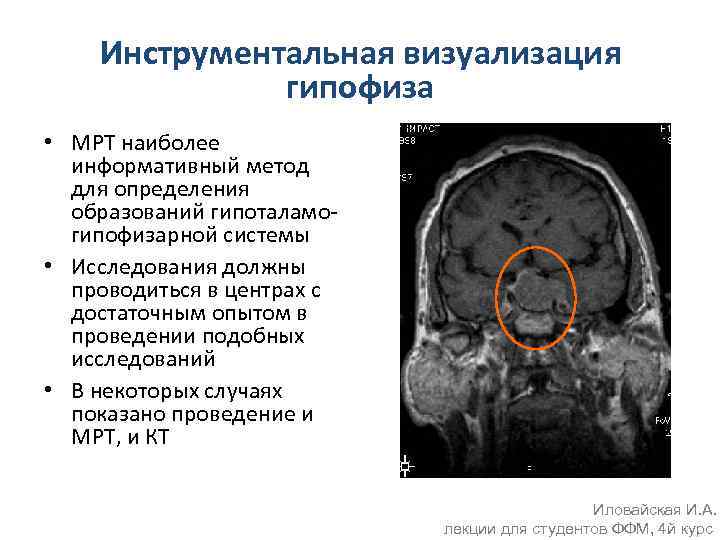 Инструментальная визуализация гипофиза • МРТ наиболее информативный метод для определения образований гипоталамогипофизарной системы •