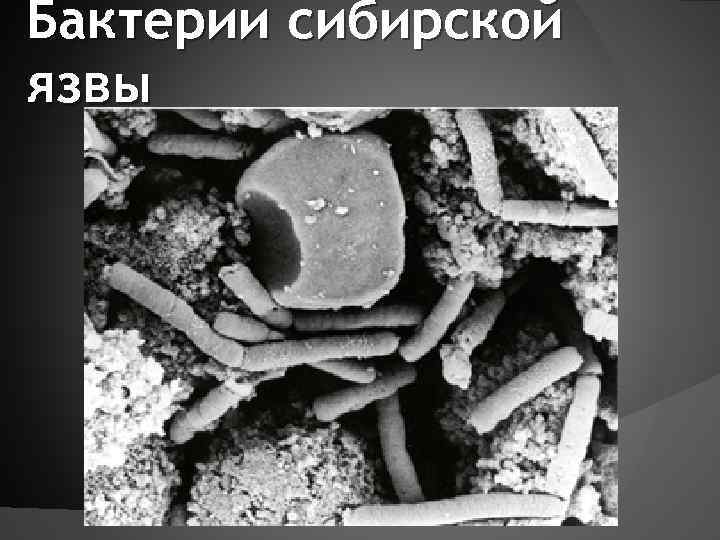 Бактерии сибирской язвы Bacillus anthracis 