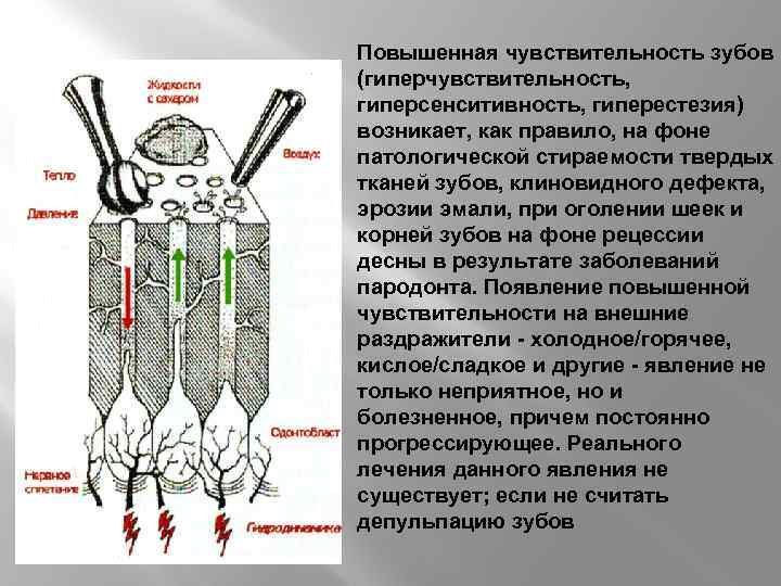 Как увеличить чувствительность. Чувствительность зубов. Гиперестезия твердых тканей зуба. Повышенная чувствительность зуба. Гиперестезия классификация.